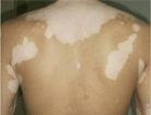 ݰҽԺ